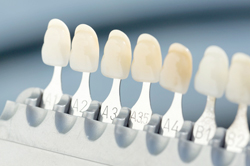 西鉄平尾駅・【松尾歯科クリニック】・ウォーキングブリーチ(神経がない歯の漂白）