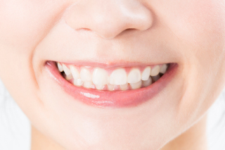 西鉄平尾駅・【松尾歯科クリニック】・ダイレクトボンディング